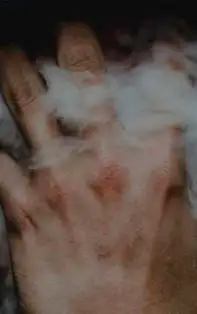 Efectele fumatului asupra pielii și îngrijirea specifică